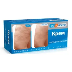 До и После антицелулитен крем 100 мл